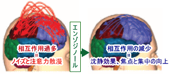 エンゾジノール 沈静効果、焦点と集中力の向上